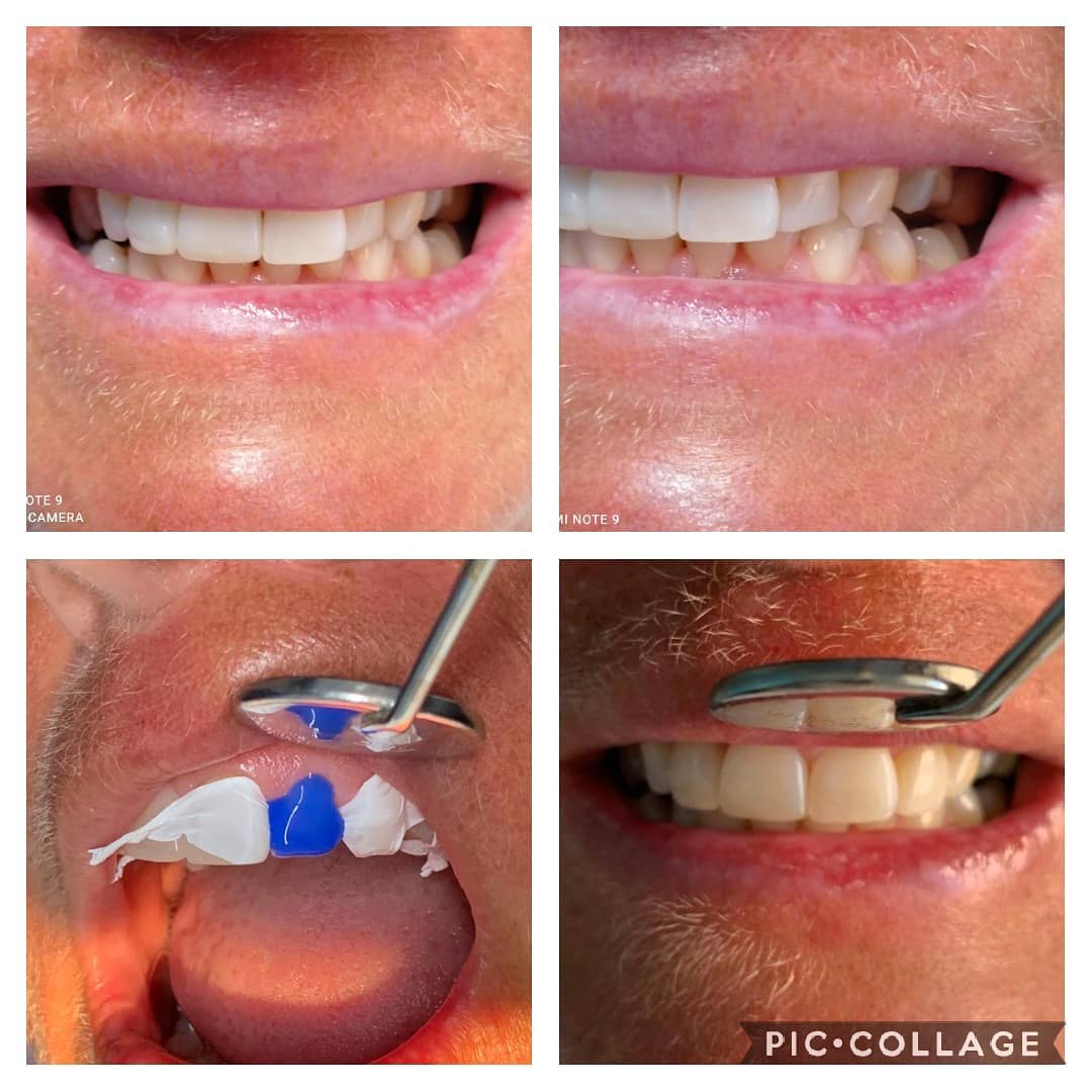 topdentistbavaro - COa5eqeLKKD